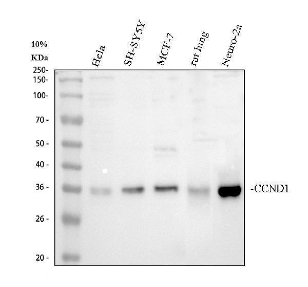 Western blot analysis of CCND1 using anti-CCND1 antibody (PB9370)
