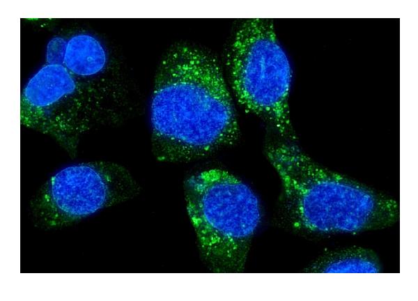 Figure 3. IF analysis of HLA A using anti-HLA A antibody (PB9376). HLA A was detected in immunocytochemical section of A431 cells. Enzyme antigen retrieval was performed using IHC enzyme antigen retrieval reagent (AR0022) for 15 mins. The cells were blocked with 10% goat serum. And then incubated with 5microg/mL rabbit anti-HLA A Antibody (PB9376) overnight at 4°C. DyLight®488 Conjugated Goat Anti-Rabbit IgG (BA1127) was used as secondary antibody at 1:100 dilution and incubated for 30 minutes at 37°C. The section was counterstained with DAPI. Visualize using a fluorescence microscope and filter sets appropriate for the label used.