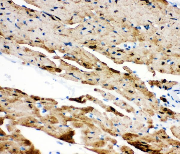  IHC analysis of PLN using anti-PLN antibody (PB9381)