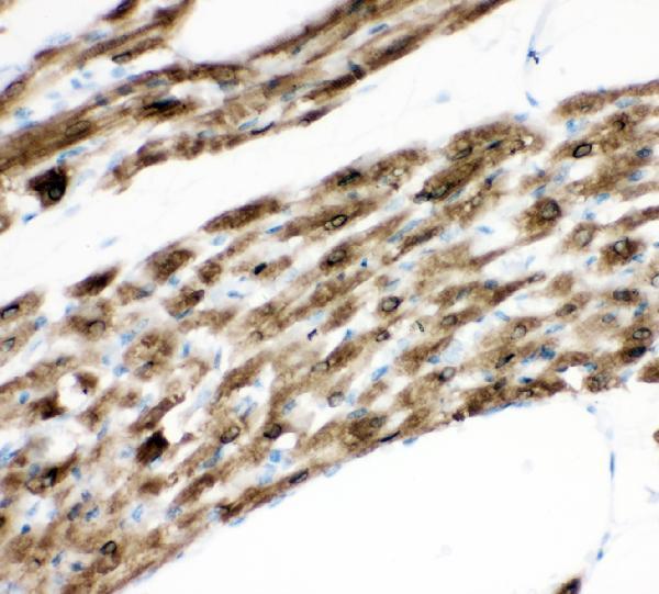  IHC analysis of PLN using anti-PLN antibody (PB9381)