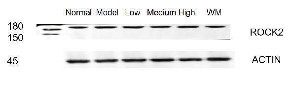  Western blot analysis of ROCK2 using anti-ROCK2 antibody (PB9387)