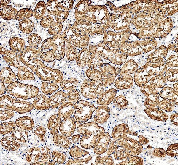 pb9394 slc22a2 primary antibodies ihc testing 1