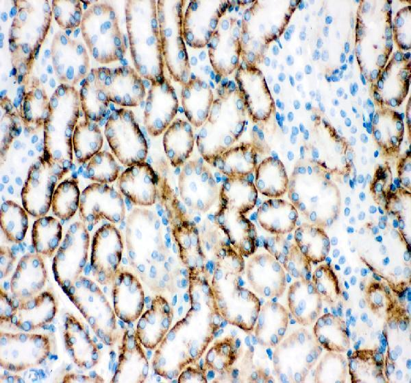 pb9394 slc22a2 primary antibodies ihc testing 2