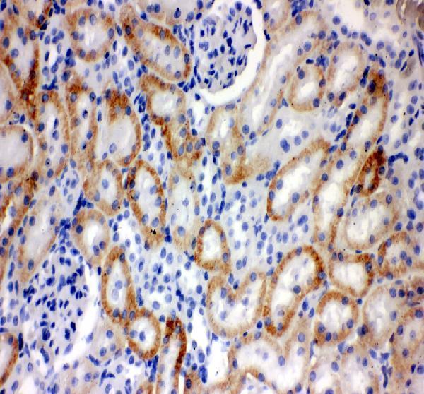 pb9394 slc22a2 primary antibodies ihc testing 3
