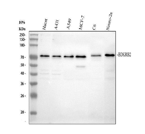 pb9396 bdkrb2 primary antibodies wb testing 1