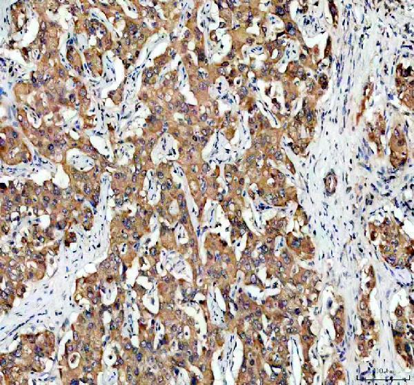 pb9396 smad3 primary antibodies ihc testing 1