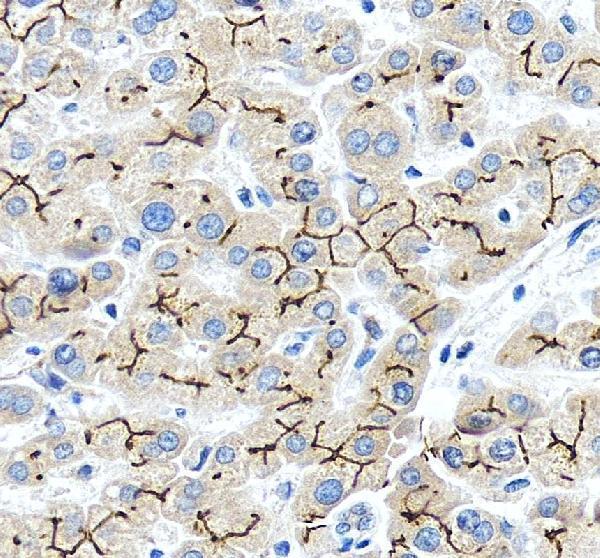 IHC analysis of BSEP/ABCB11 using anti-BSEP/ABCB11 antibody (PB9414)