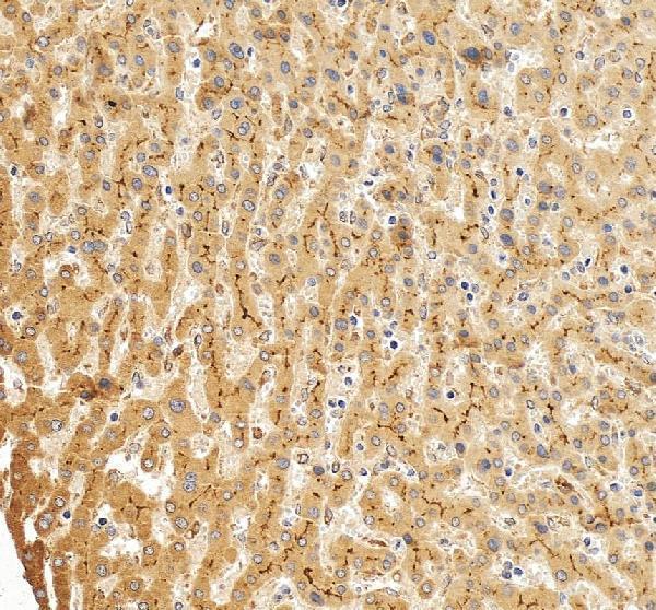 IHC analysis of BSEP/ABCB11 using anti-BSEP/ABCB11 antibody (PB9414)
