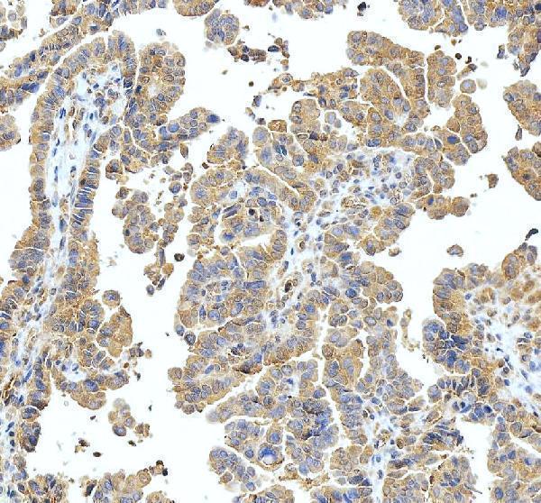IHC analysis of ABI1 using anti-ABI1 antibody (PB9416)