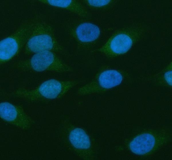 IF analysis of ANXA3 using antiANXA3 antibody (PB9420)
