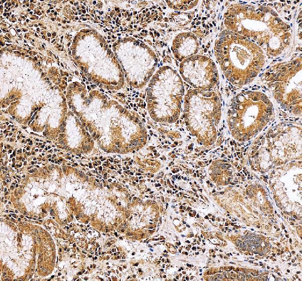 IHC analysis of ANXA3 using anti-ANXA3 antibody (PB9420)