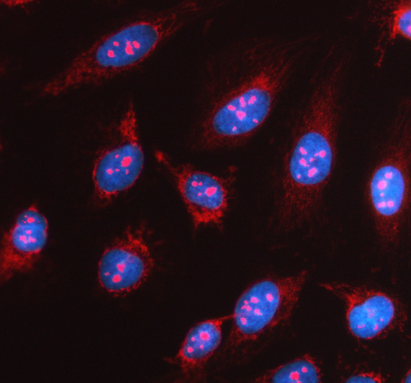 pb9434 sgk1 primary antibodies if testing 1