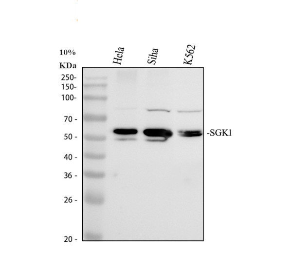 pb9434 sgk1 primary antibodies wb testing 1
