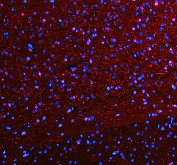 pb9438 slc6a4 primary antibodies if testing 6