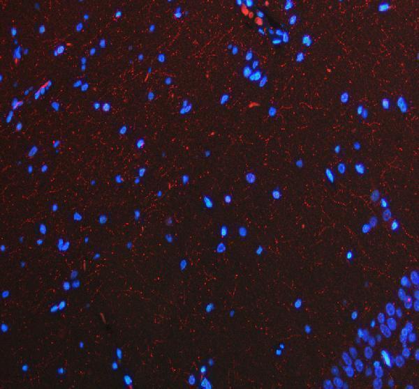 pb9438 slc6a4 primary antibodies if testing 7