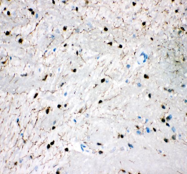 pb9438 slc6a4 primary antibodies ihc testing 4