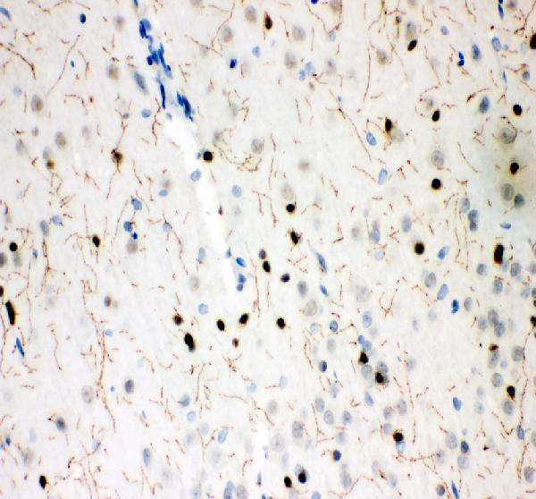 pb9438 slc6a4 primary antibodies ihc testing 5