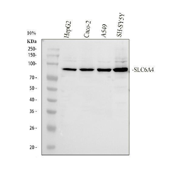  Western blot analysis of SLC6A4 using anti-SLC6A4 antibody (PB9438)