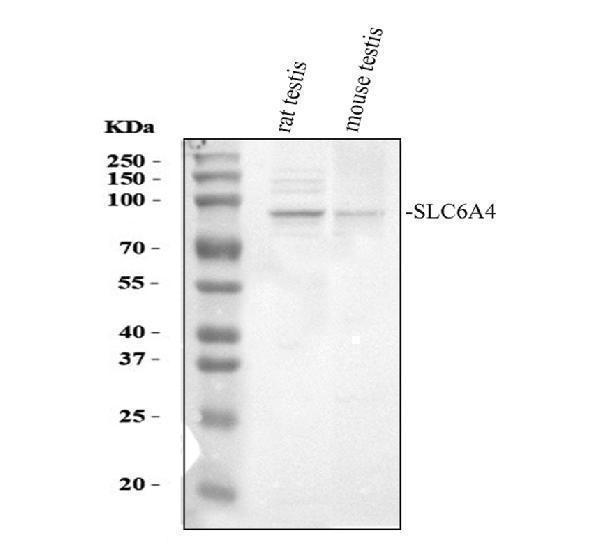  Western blot analysis of SLC6A4 using anti-SLC6A4 antibody (PB9438)