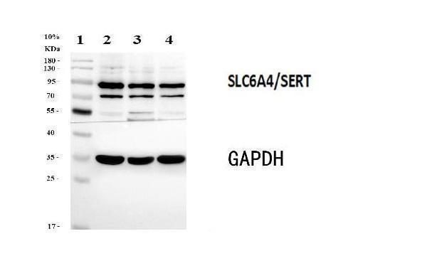 pb9438 slc6a4 primary antibodies wb testing 4_1