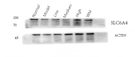 pb9438 slc6a4 primary antibodies wb testing 5