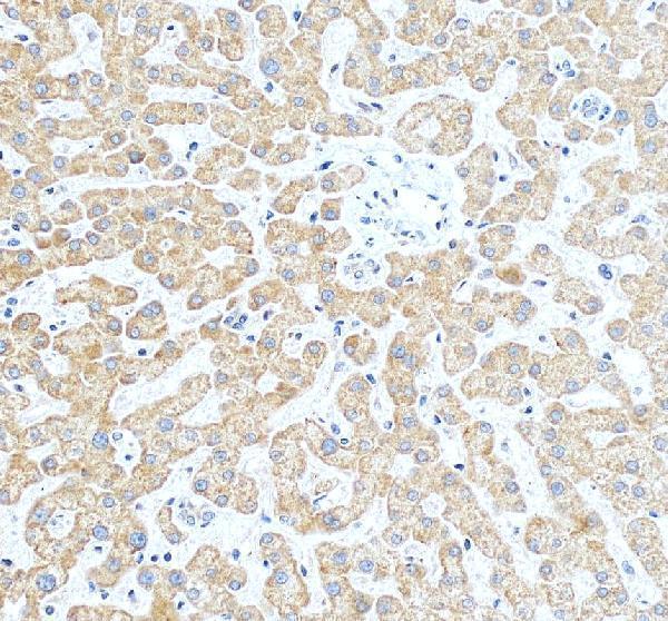 IHC analysis of SNAI2 using anti-SNAI2 antibody (PB9439)