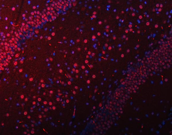 pb9441 snrpn primary antibodies if testing 12