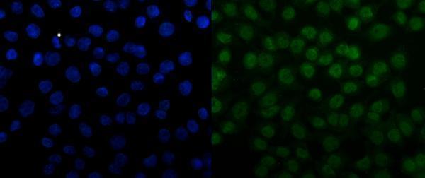 pb9441 snrpn primary antibodies if testing 9