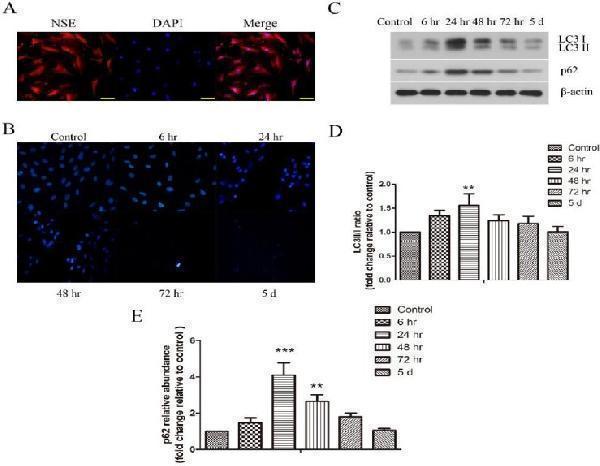 pb9444 ijbms 20 1029 g003
