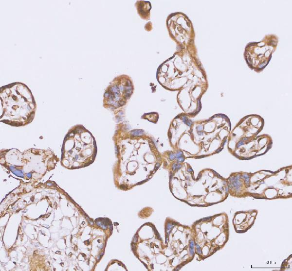 IHC analysis of TGM2 using anti-TGM2 antibody (PB9448)