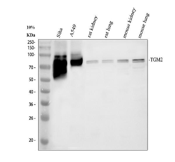 Western blot analysis of TGM2 using anti-TGM2 antibody (PB9448)