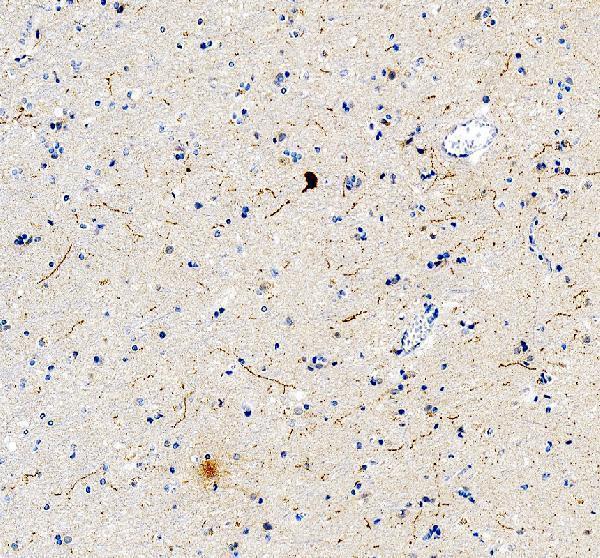 IHC analysis of Tyrosine Hydroxylase/TH using anti-Tyrosine Hydroxylase/TH antibody (PB9449)