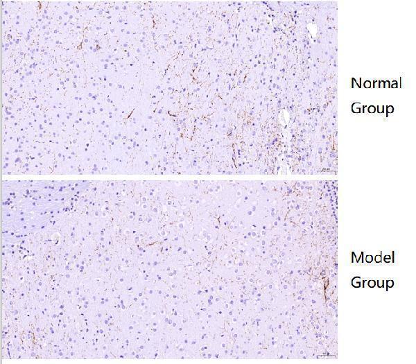  IHC analysis of Tyrosine Hydroxylase/TH using anti-Tyrosine Hydroxylase/TH antibody (PB9449)