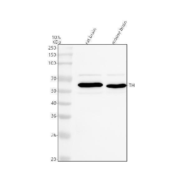  Western blot analysis of Tyrosine Hydroxylase/TH using anti-Tyrosine Hydroxylase/TH antibody (PB9449)
