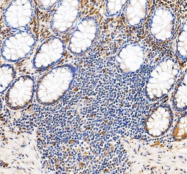 IHC analysis of TLR5 using anti-TLR5 antibody (PB9451)