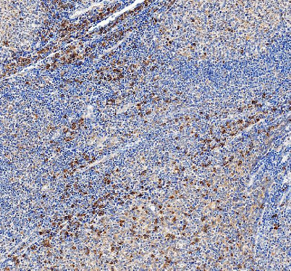IHC analysis of TLR5 using anti-TLR5 antibody (PB9451)