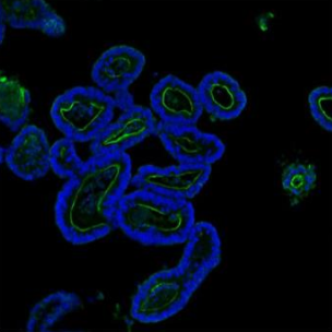 pb9457 villin primary antibodies if testing 11