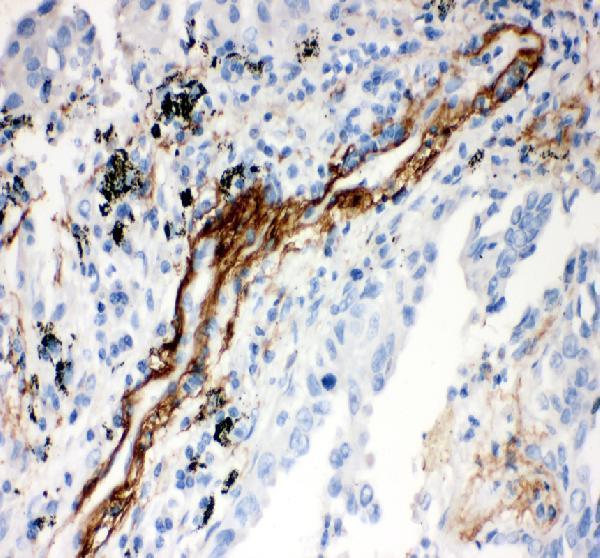 pb9458 vitronectin primary antibodies ihc testing 1