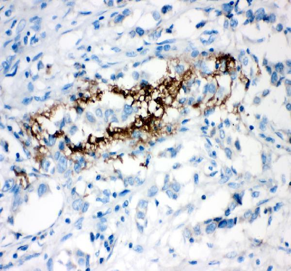 pb9458 vitronectin primary antibodies ihc testing 2