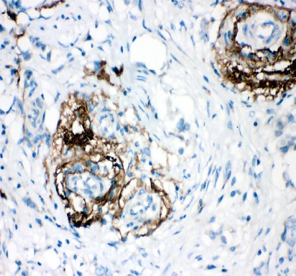 pb9458 vitronectin primary antibodies ihc testing 3
