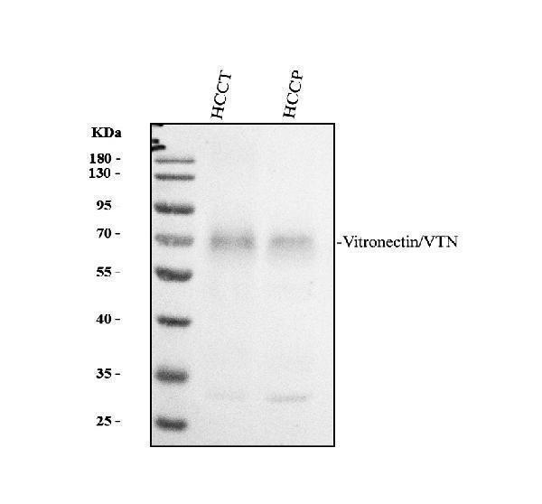 pb9458 vitronectin primary antibodies wb testing 1