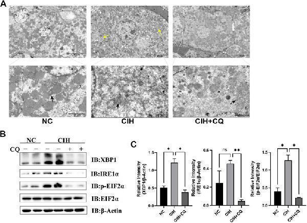 Inhibition of autophagic flux alleviated hepatocyte ER stress and LD accumulation