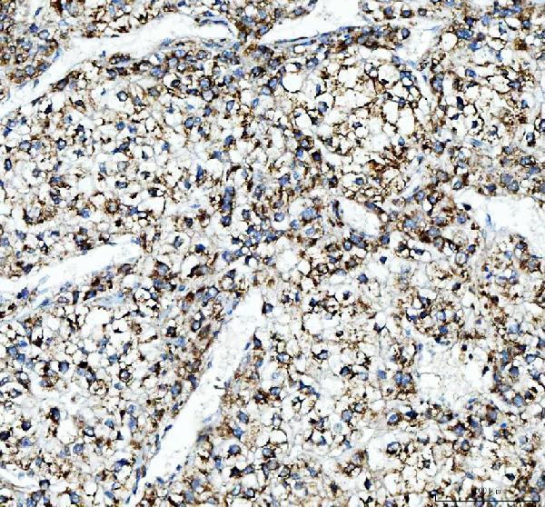 IHC analysis of ALDH2 using anti-ALDH2 antibody (PB9473)