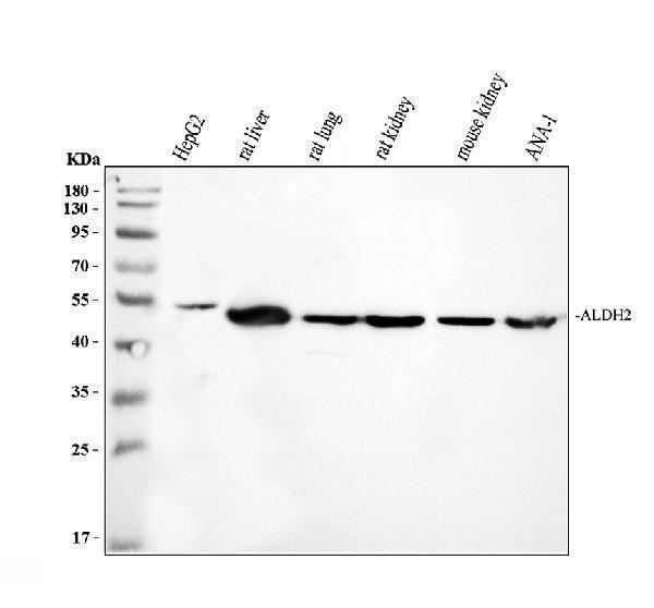 Western blot analysis of ALDH2 using anti-ALDH2 antibody (PB9472)