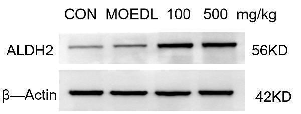 Western blot analysis of ALDH2 using anti-ALDH2 antibody (PB9472)