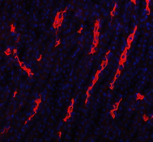 pb9473 aqp1 primary antibodies if testing 5
