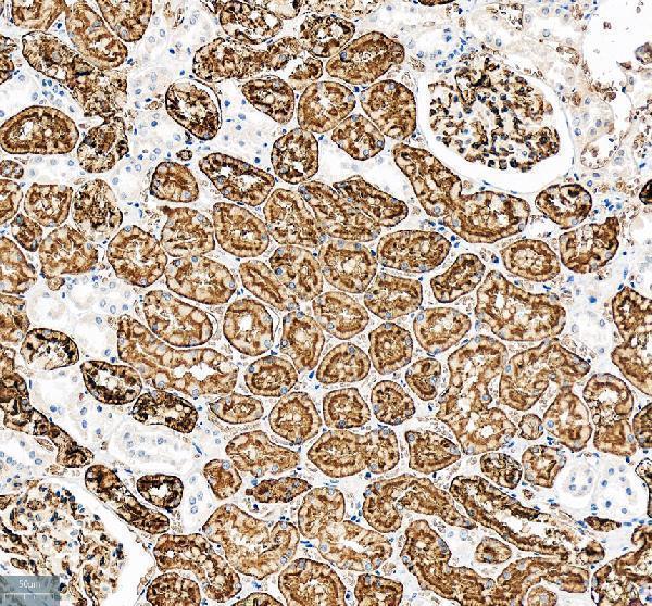 pb9473 aqp1 primary antibodies ihc testing 2_1
