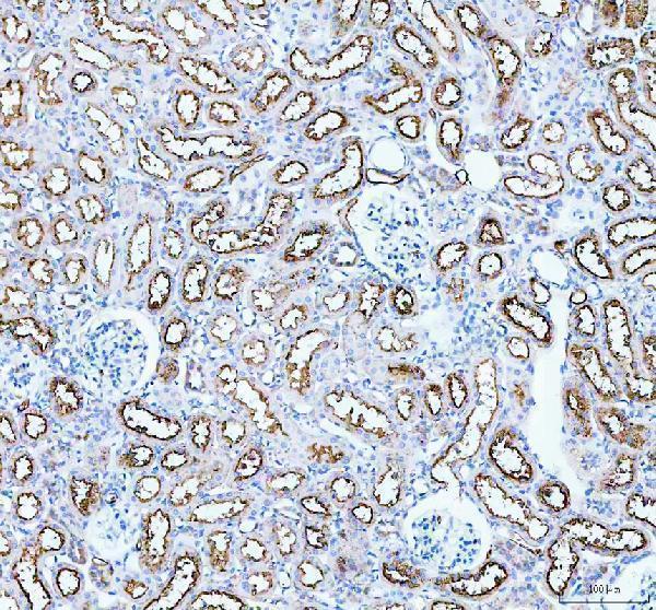 pb9473 aqp1 primary antibodies ihc testing 3_1