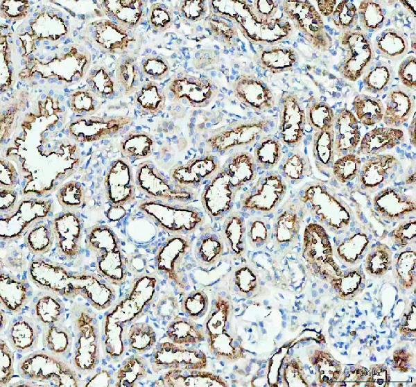 pb9473 aqp1 primary antibodies ihc testing 4_1