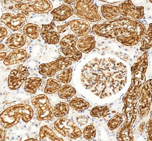 pb9473 aqp1 primary antibodies ihc testing 5